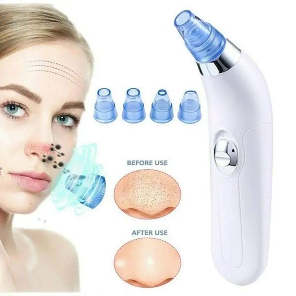 Вакуумний очисник Derma suction DS Vacuum для професійної чистки шкіри та пор обличчя - легкий компактний зручний прилад у використанні + 4 насадки, Білий 205021 фото