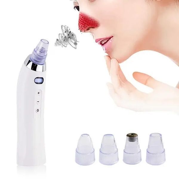 Вакуумний очисник Derma suction DS Vacuum для професійної чистки шкіри та пор обличчя - легкий компактний зручний прилад у використанні + 4 насадки, Білий 205021 фото