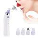 Вакуумний очисник Derma suction DS Vacuum для професійної чистки шкіри та пор обличчя - легкий компактний зручний прилад у використанні + 4 насадки, Білий 205021 фото 2