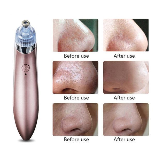 Вакуумний апарат для чищення пор Beauty Skin Care Specialist XN-8030 Найкраща ціна! 900012 фото