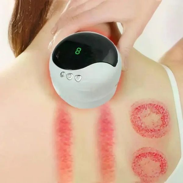 Антицелюлітний вакуумний масажер Intelligent Cupping Massage, акумуляторний ручний масажер для тіла Білий LY-873-White 2054090 фото