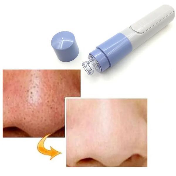 Вакуумний очищувач пор Pore Cleaner 226204 фото