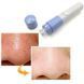 Вакуумний очищувач пор Pore Cleaner 226204 фото 2