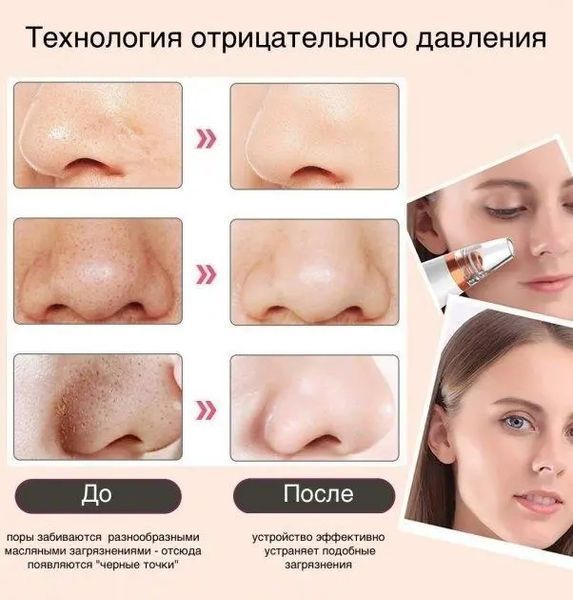 Вакуумний очищувач шкіри та пор Multi-Functional для чищення обличчя 205552001357 фото