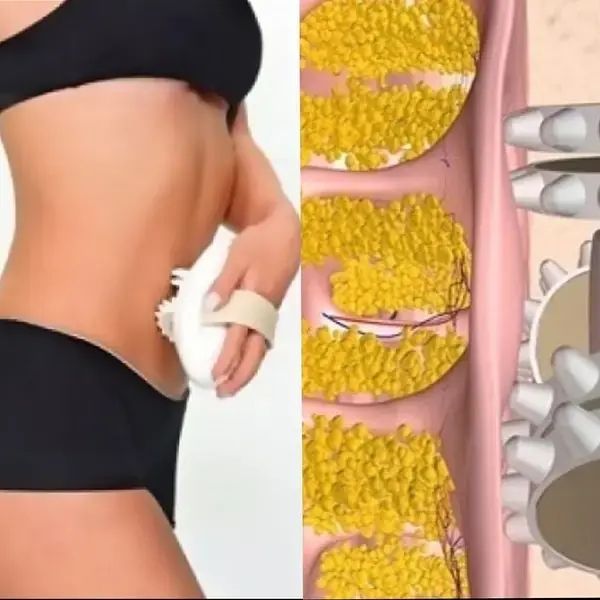 Масажер антицелюлітний Shuqin Body Slimmer SQ 100 sp859642 фото